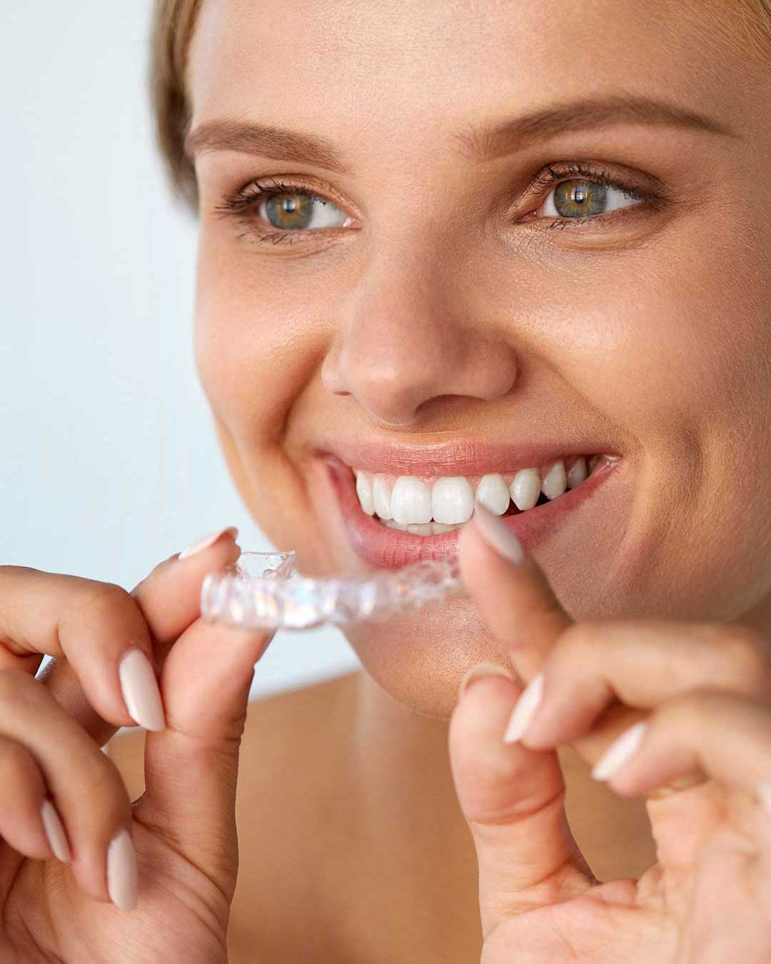 Clear Aligners Dubai